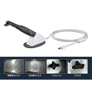 ダイアグノカム